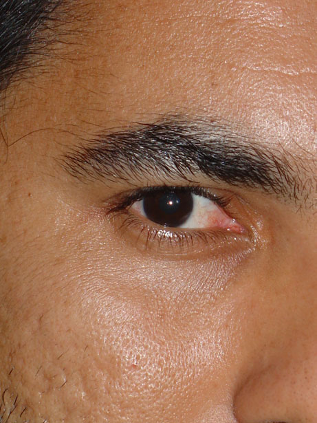 Male eye