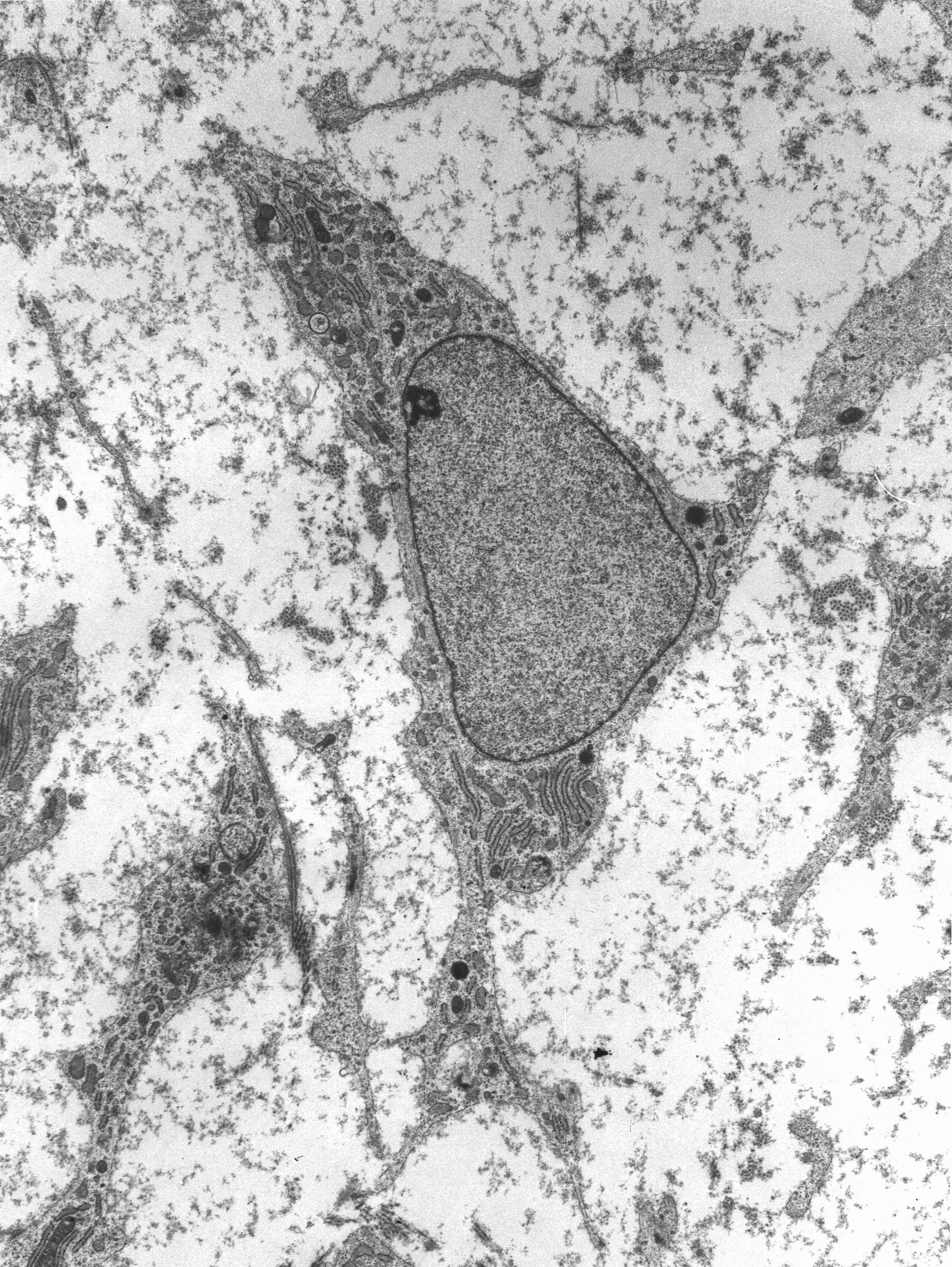 Stem-Cell To Photoreceptor Cells Treatment Advancements