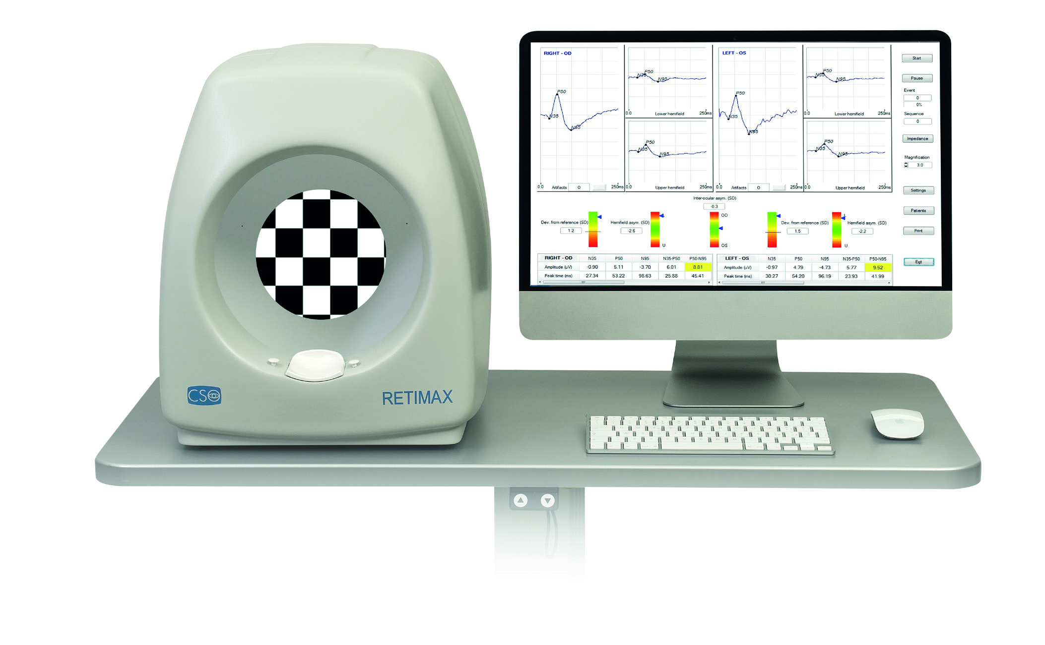 CSO Retimax Basic - Electrophysiology CSO Retimax Basic - Electrophysiology