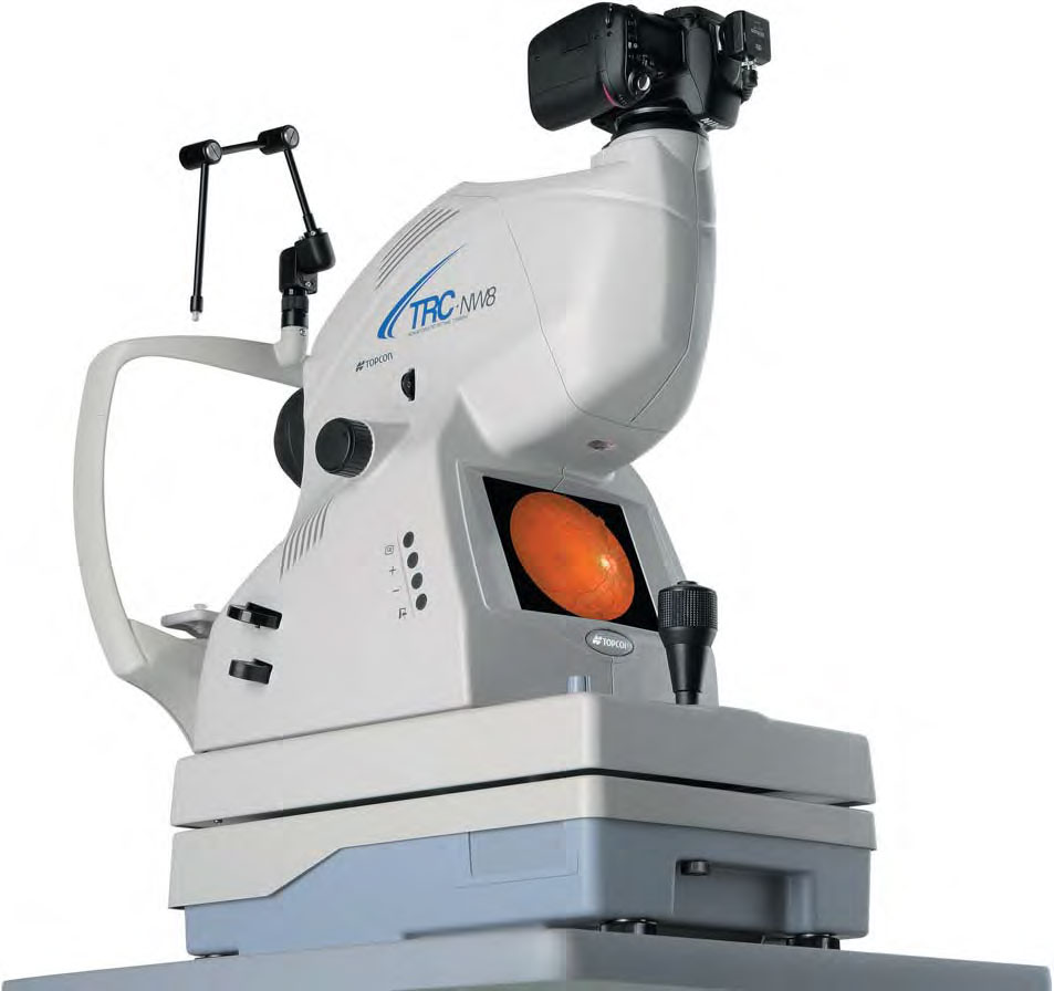 Topcon NW8 Fundus Camera