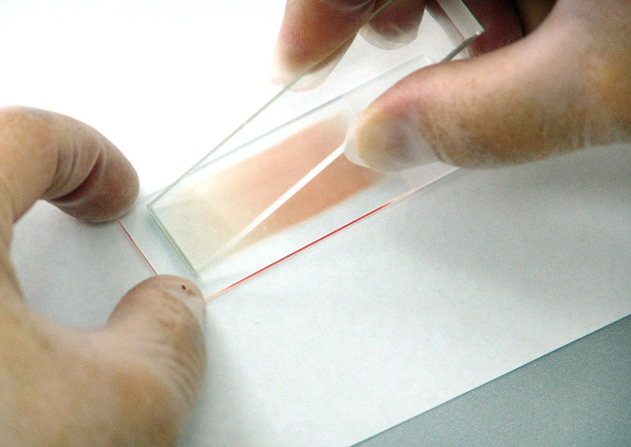 diabetes blood testing in opticians