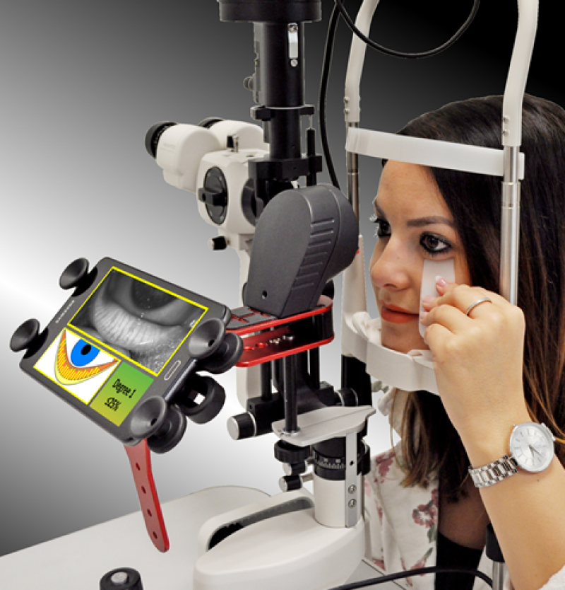 Hanson Instruments| Hanson appointed UK distributor for Espansione Group’s Dry-Eye products