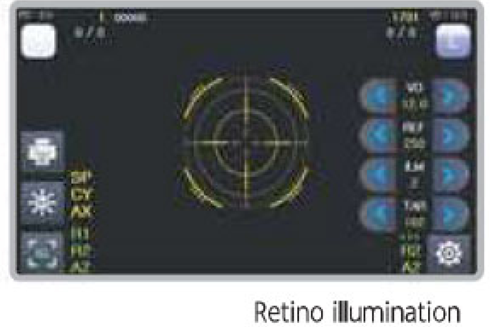 Unicos URK800a Auto Refractor/Keratometer