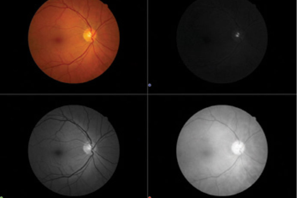 Canon CR2 Digital Retinal Camera RGB