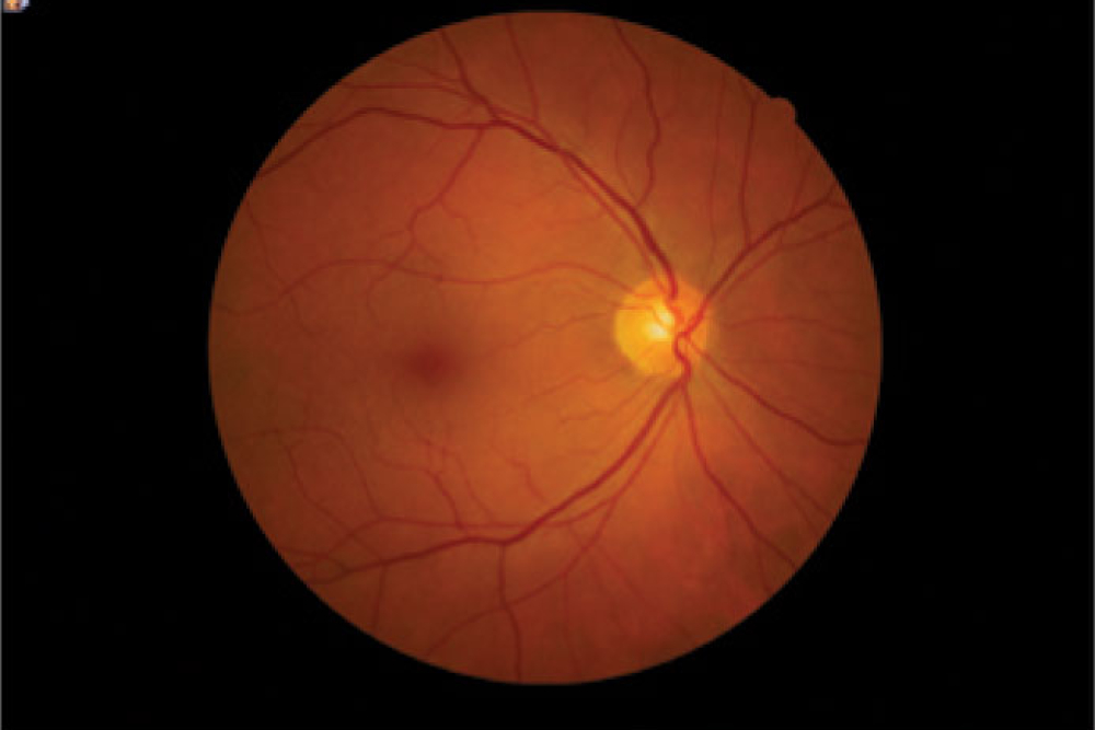 Canon CR2 Digital Retinal Camera Colour