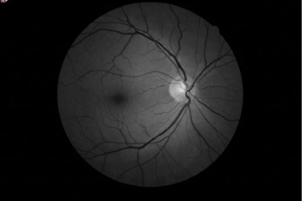 Canon CR2 Digital Retinal Camera Digital Red Free