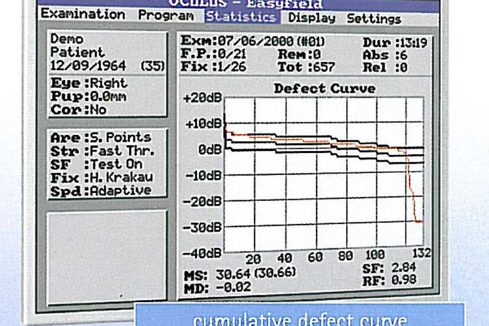 Oculus Easyfield - Cumulative Defect Curve