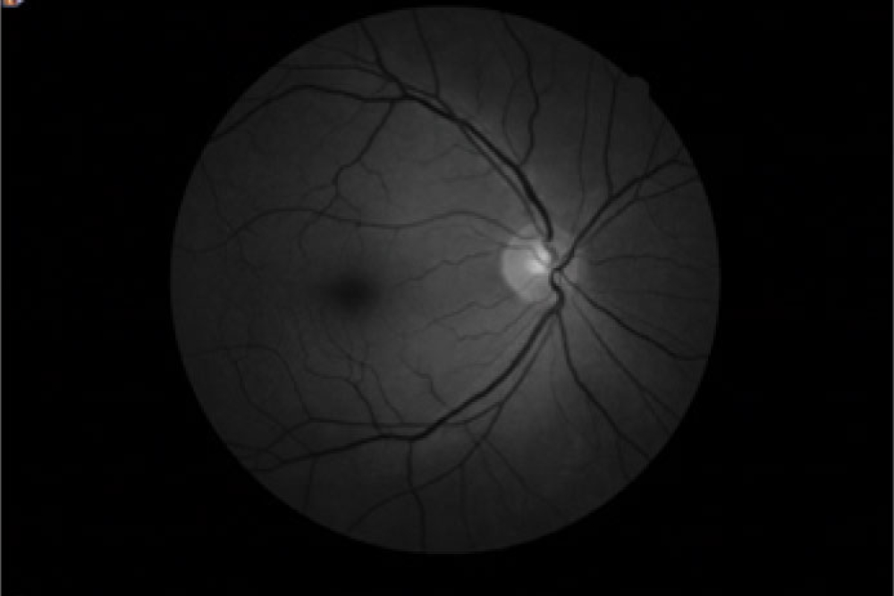 Canon CR2 Digital Retinal Camera Digital Cobalt