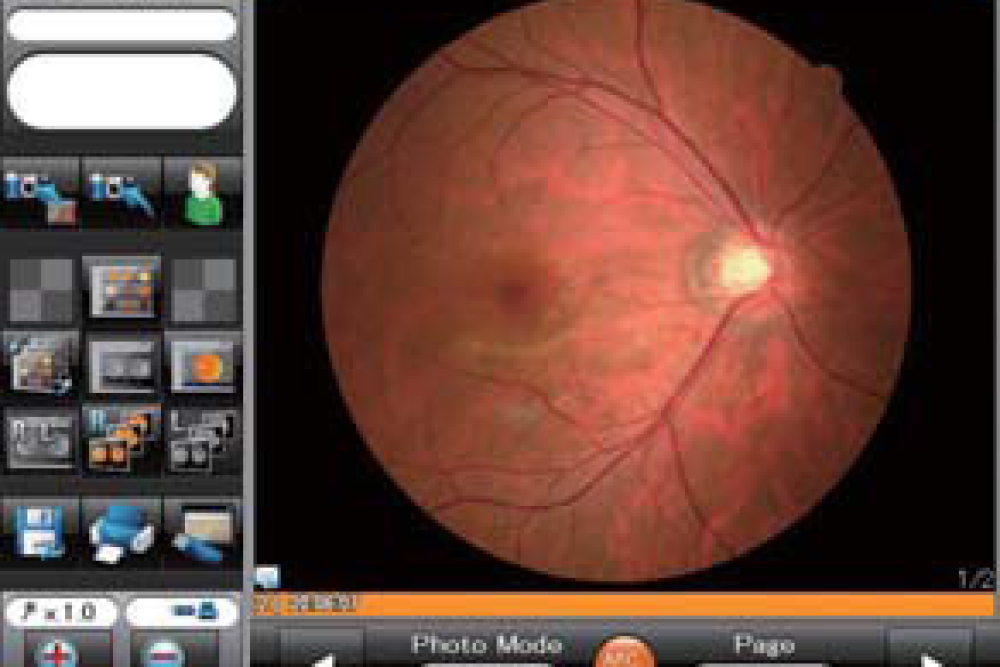 Touch Screen - Nidek AFC 330 Fundus Camera