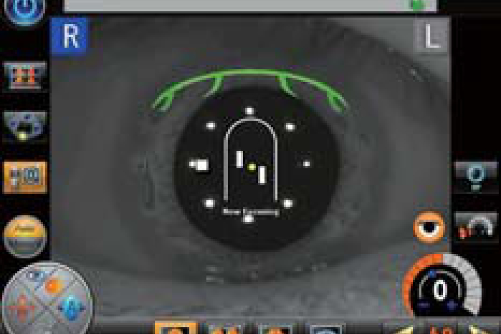 Auto Switching - Nidek AFC 330 Fundus Camera
