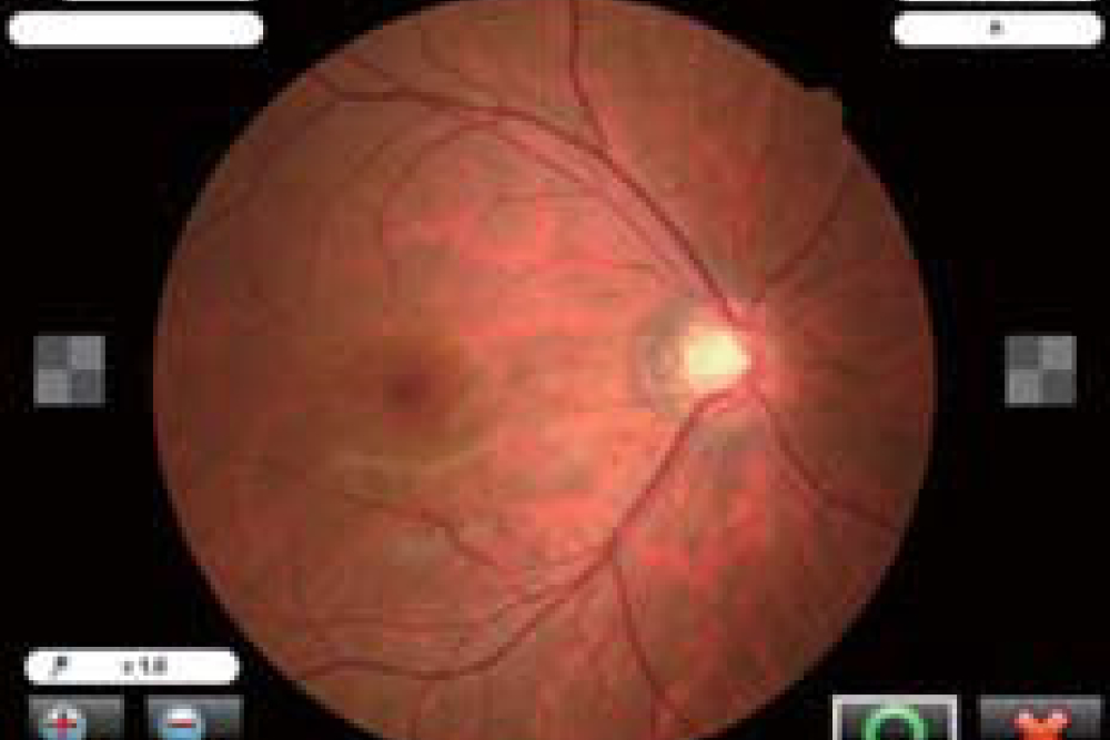 Image Check - Nidek AFC 330 Fundus Camera