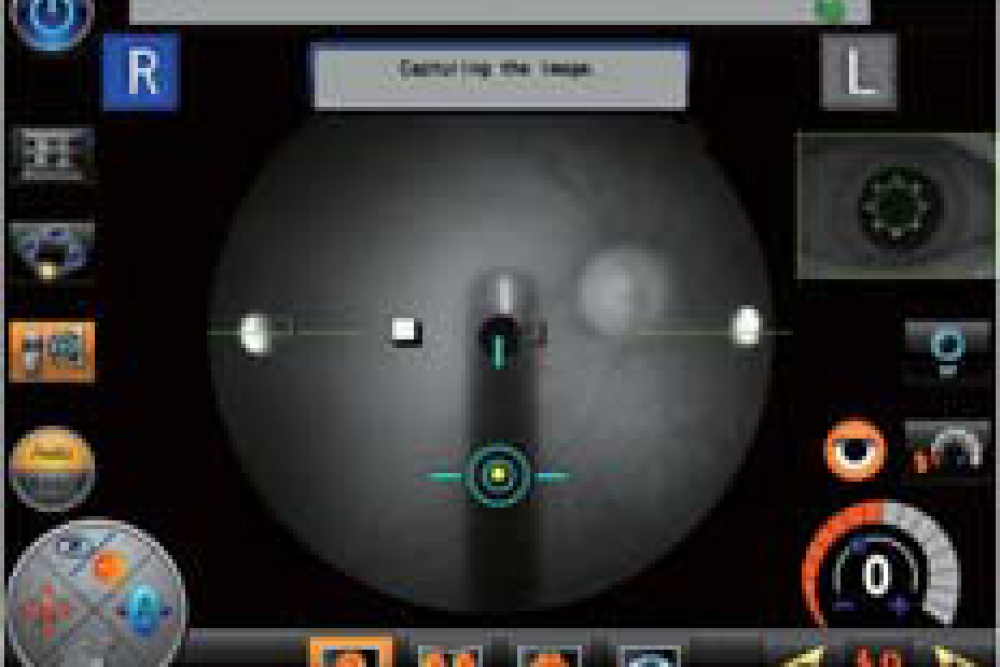 Auto Shot - Nidek AFC 330 Fundus Camera