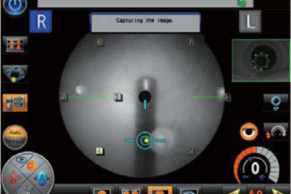 Navigation of Panorama Photo - Nidek AFC 330 Fundus Camera