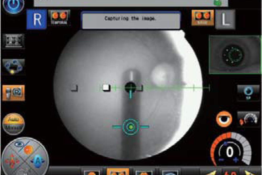 Navigation of Stereo Photo - Nidek AFC 330 Fundus Camera