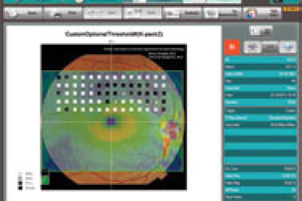 Kowa AP 7000 Field Screener
