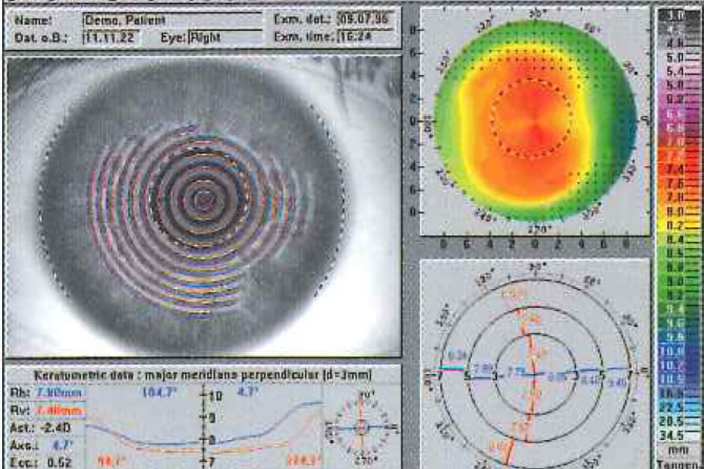 Oculus Concepta Combi Unit