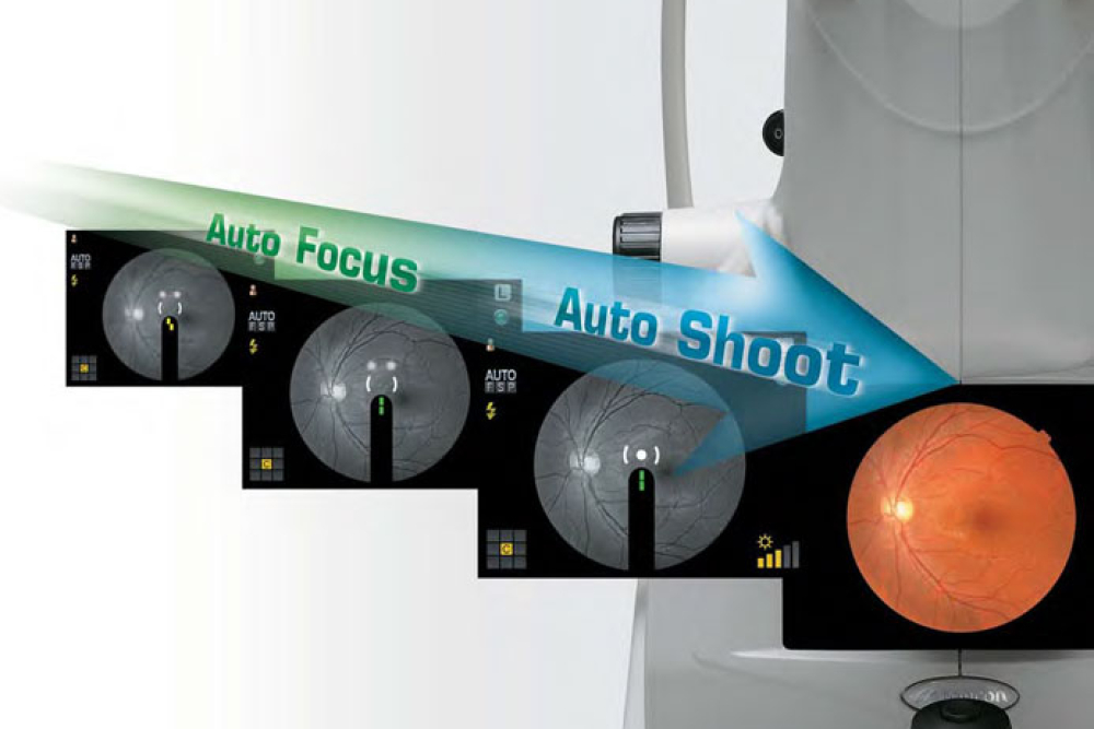 Topcon NW8 Fundus Camera
