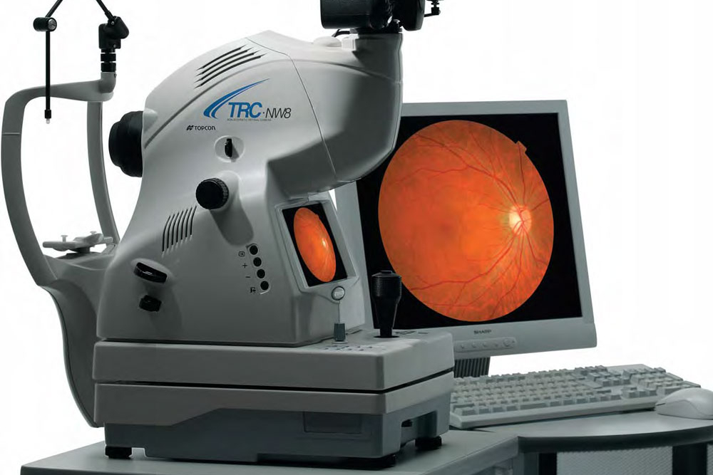 Topcon NW8 Fundus Camera