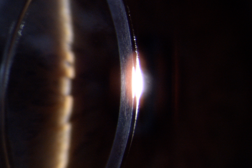 CSO MIZAR for Slit Lamps