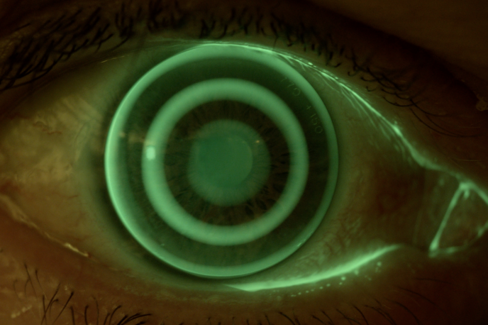 CSO MIZAR for Slit Lamps