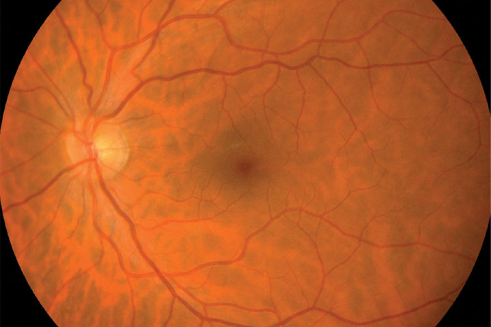 High Resolution Acquisition CSO Cobra HD