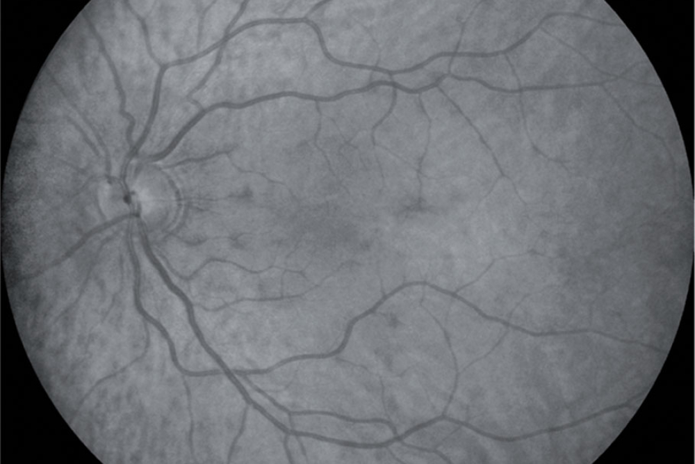 Infrared Picture Acquisition CSO Cobra HD