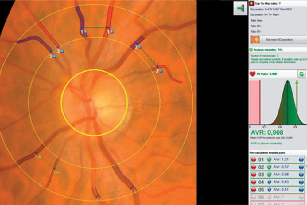 AVr Evaluation Tool CSO Cobra HD
