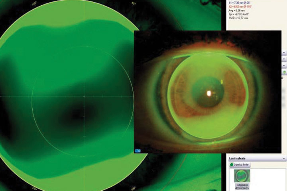 Autofit module, lens database search - CSO Sirius Topographer