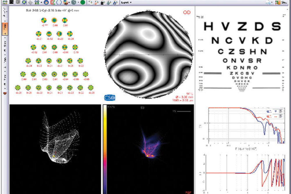 Corneal aberrometry analysis - CSO Sirius Topographer