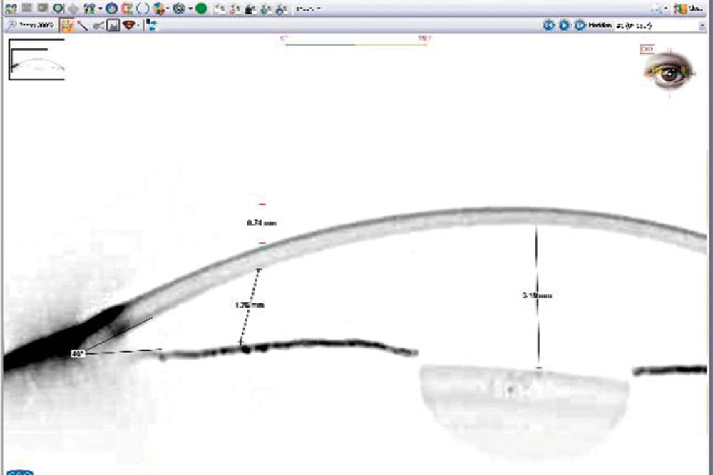 CSO Sirius Topographer