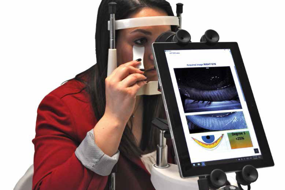 me-check - Dry Eye and Meibomian Glands Screener