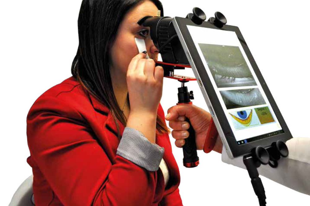 me-check - Dry Eye and Meibomian Glands Screener