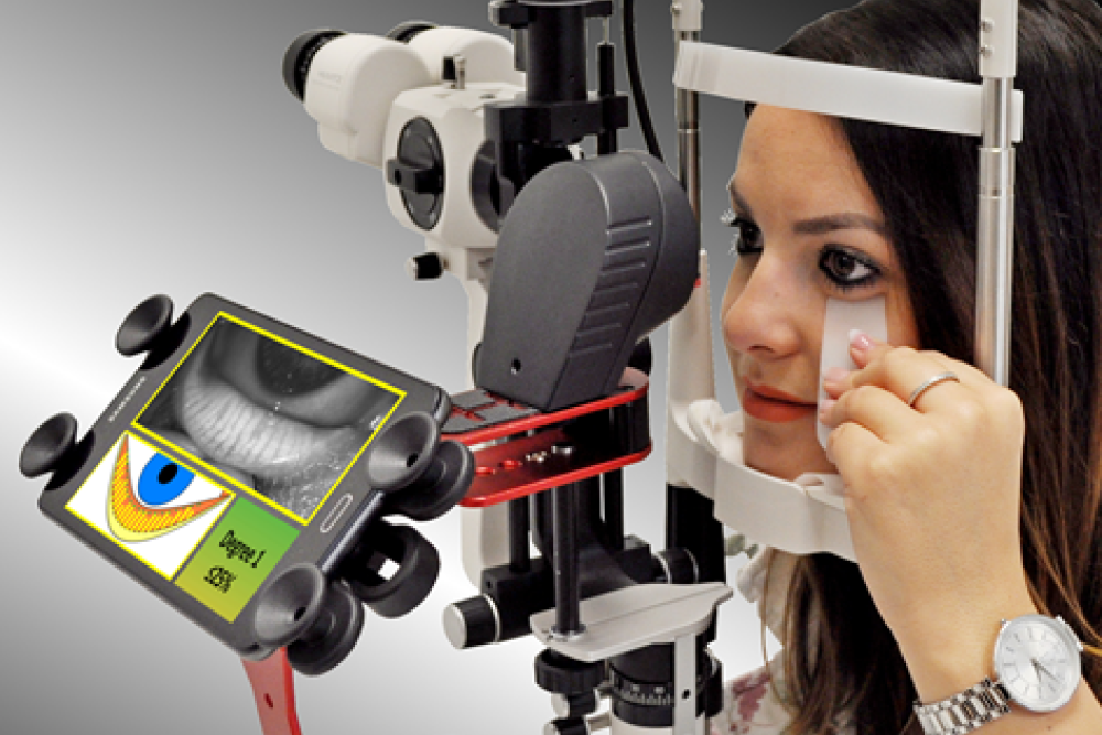 me-check - Dry Eye and Meibomian Glands Screener