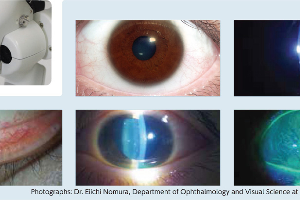 Kowa SL-17 LED Slit Lamp